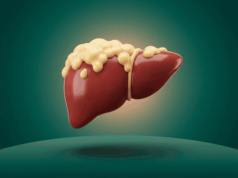 The fat coming off the liver